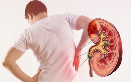 What to Expect During a Kidney Stone Treatment in Jaipur