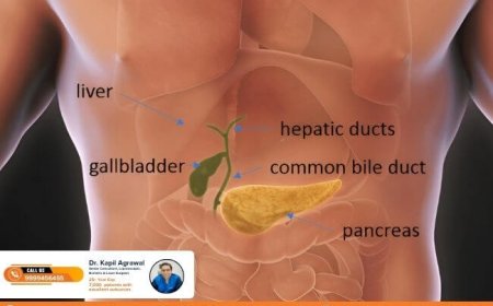 Best Gallbladder Surgeon in Delhi: A Guide to Choosing the Right Specialist