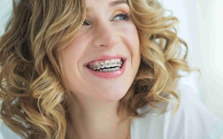 Tailored Orthodontic Plans That Work for You in Bangor